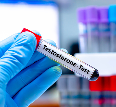 Testosterone test for metabolism and RMR Testosterone test for metabolism and RMR